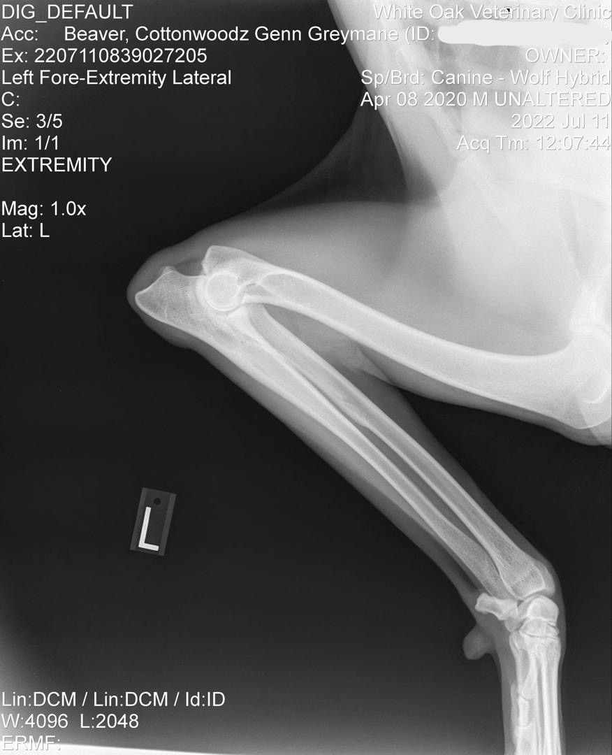 Genn Official Left Elbow X-Ray